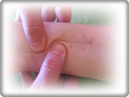 Narbenbehandlung